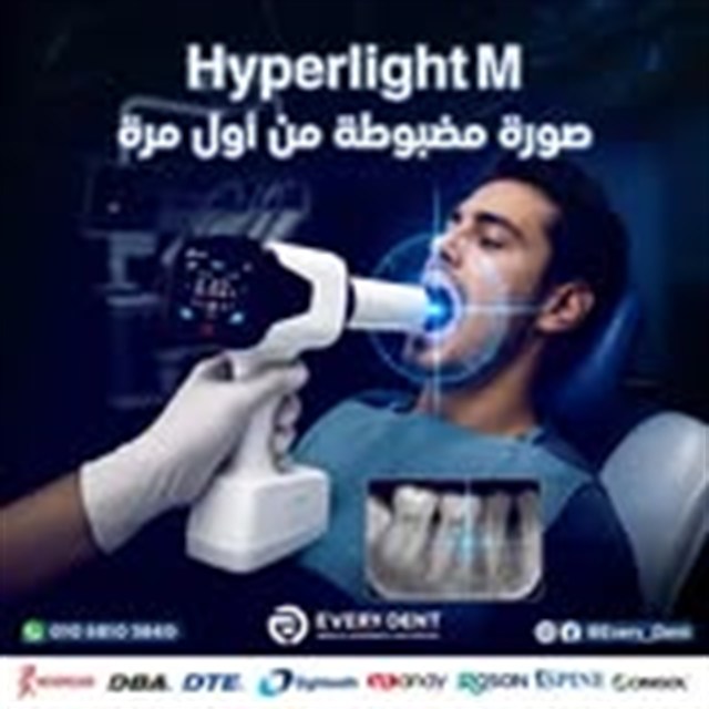 عرض جهاز Hyperlight M